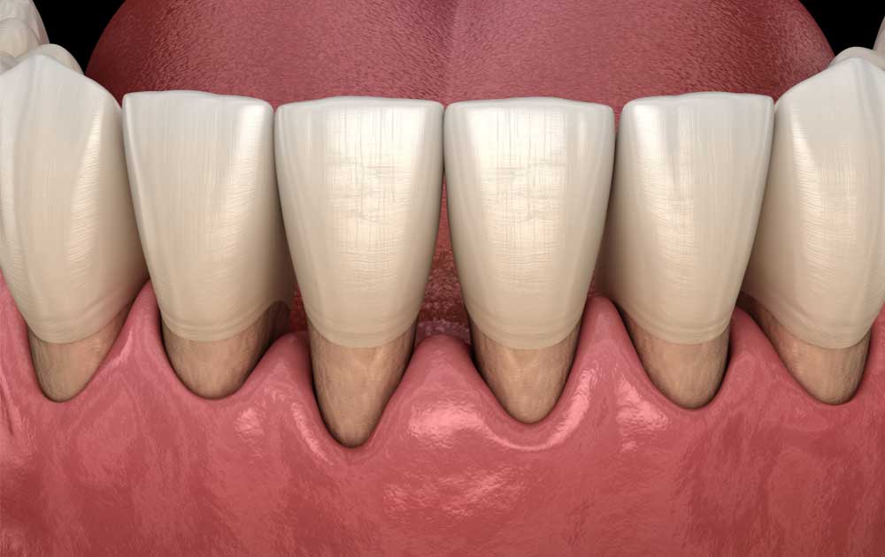 sensetive-teeth-1